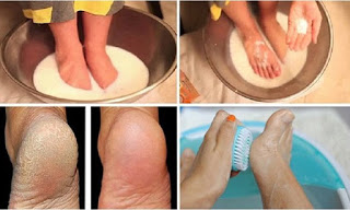 Make-Your-Feet-Look-Nice-With-Just-Two-Ingredients-from-Your-Kitchen
